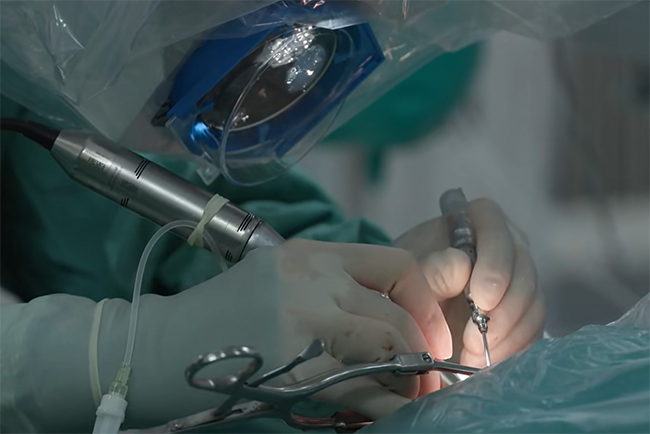 图为医生为听力残疾儿童植入人工耳蜗